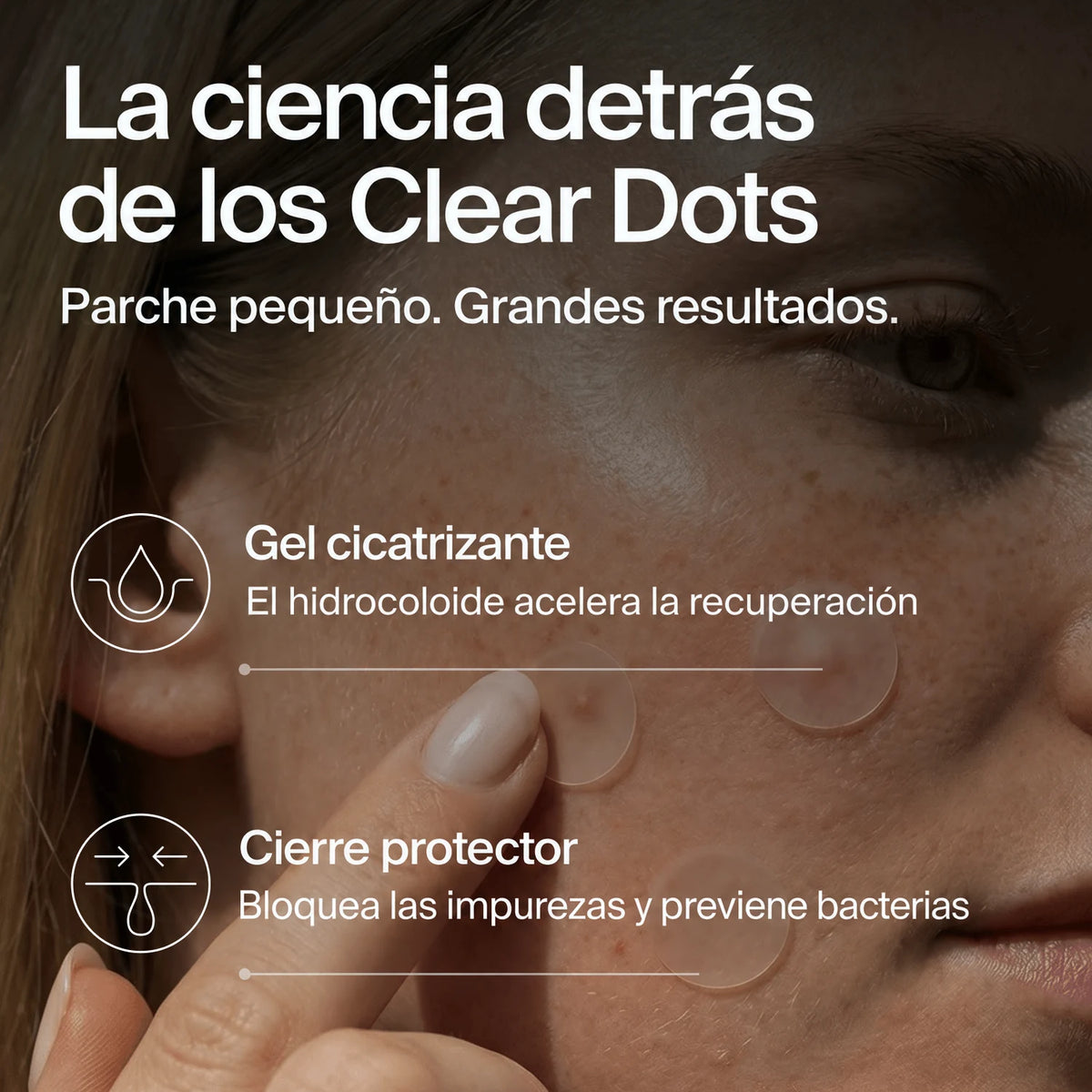 clear-dots-acne-patches gallery 5 (es)