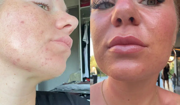 Mijn kin is eindelijk rustig