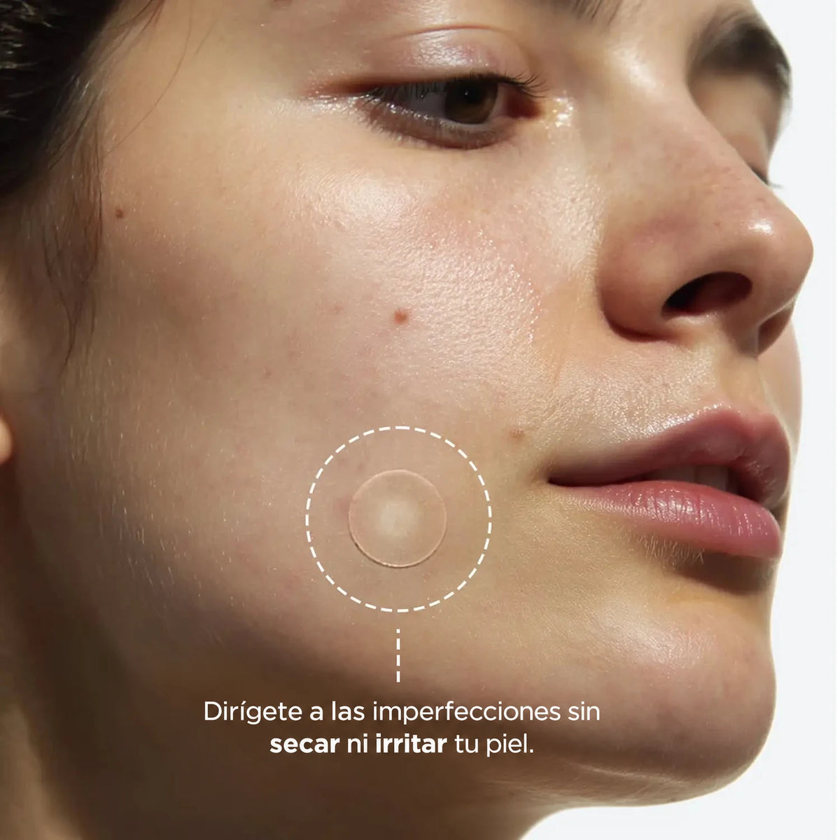 clear-dots-acne-patches gallery 3 (es)