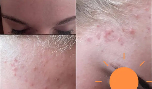 Haar huid werd rustiger, en zij ook.