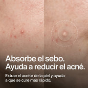 clear-dots-acne-patches gallery 2 (es)