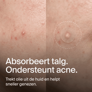Clear Dots - Acne Patches