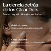 clear-dots-acne-patches gallery 5 (es)