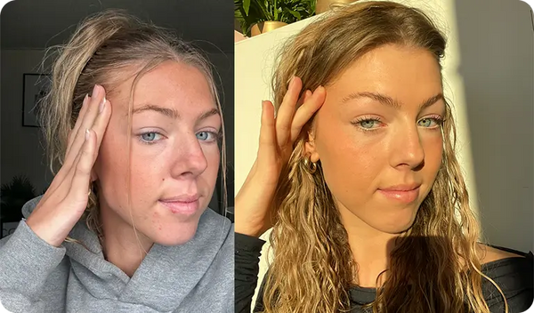 Ik dacht dat het bij mijn huid hoorde